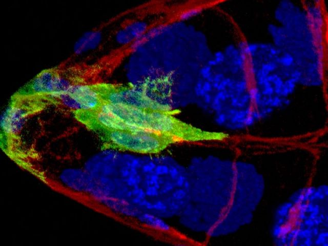 A border cell cluster initiating migrating, detaching frm the epithelium and invading between nurse cells