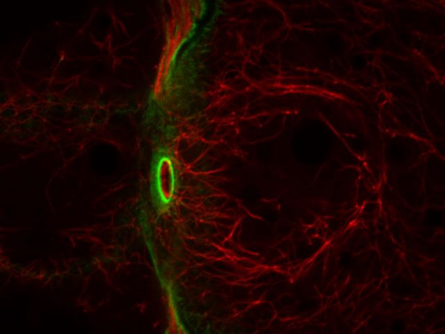 Drosophila tropomyosin (Credit: Aeri Cho)