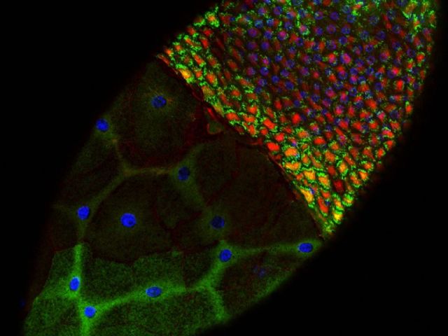 Basal surfaces of follicle cells expressing myosin (red) and paxillin (green)