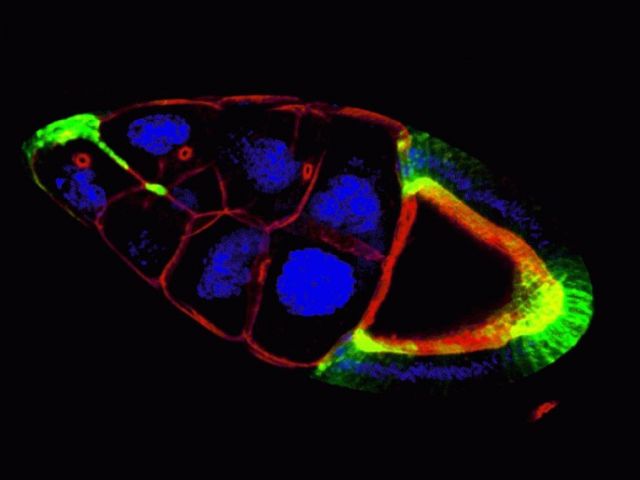 Border cells initiating migration
