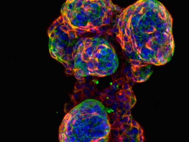 Mammary organoid (Credit: Joseph Campanale)